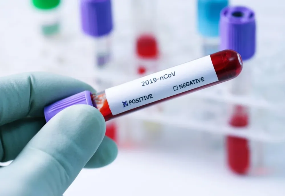 Localitatea Ciorogârla din Ilfov  a ajuns la o rată de infectare de 1,84/1000