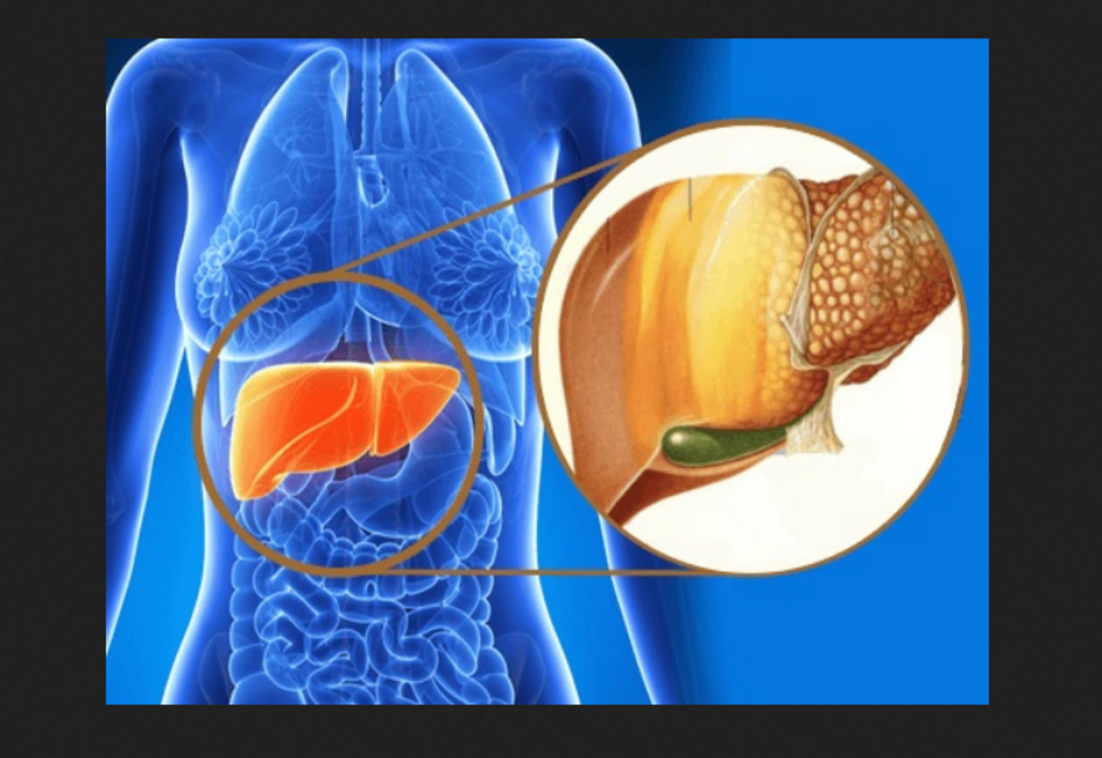 Cea mai bună metodă prin care îți poți detoxifia ficatul