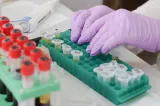 Analize medicale gratuite în 2026, chiar dacă nu ai asigurare. Dreptul pe care mulți români îlignoră