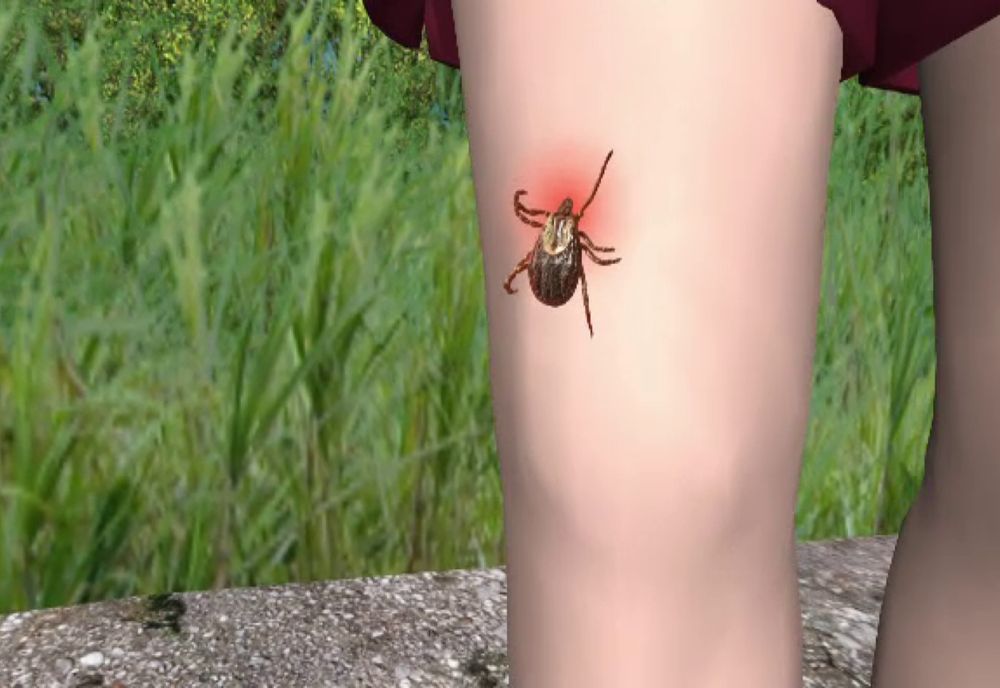 INVAZIE DE CĂPUȘE ÎN ROMÂNIA!